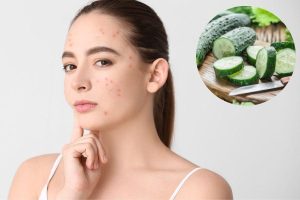 Đắp mặt nạ dưa leo như thế nào