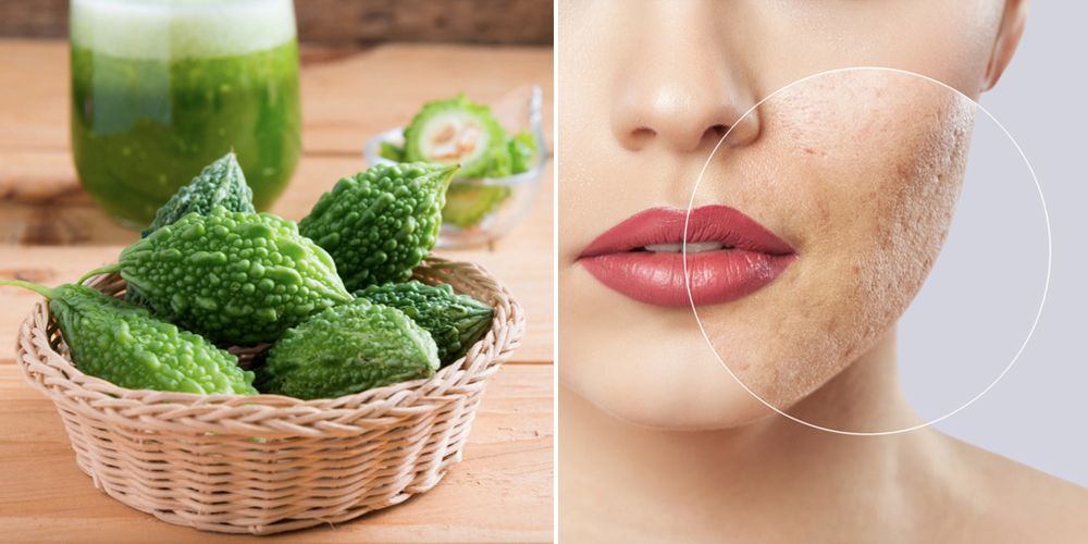 Những sai lầm thường gặp khi làm đẹp bằng mướp đắng